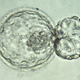 Image for article titled These are Our Picks for the Top Science Stories of 2015